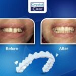 التقويم الشفاف