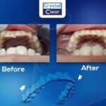 التقويم الشفاف