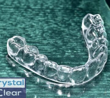 هل التقويم الشفاف أغلى ؟