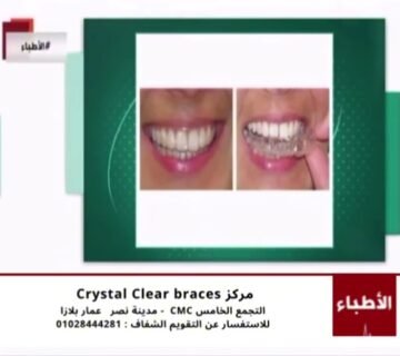 عيادة كريستال كلير - التقويم الشفاف