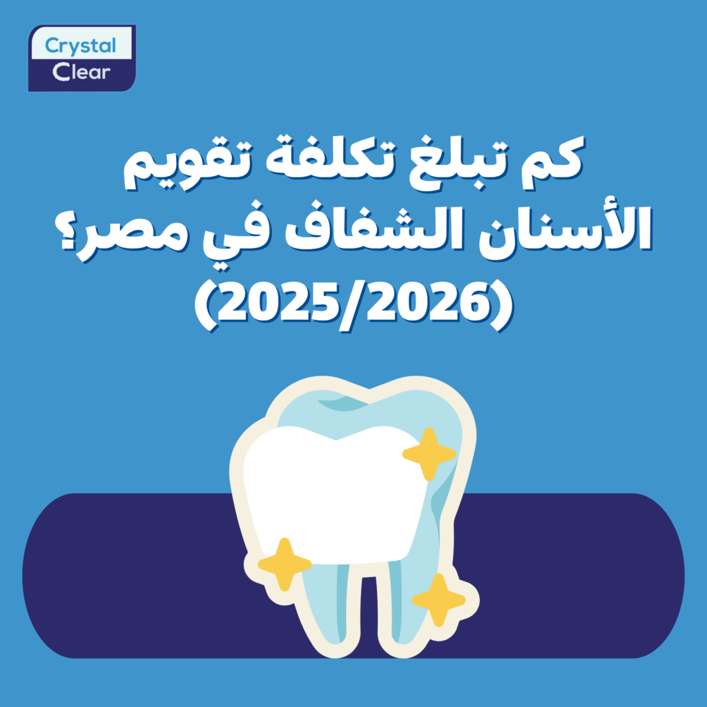 كم تبلغ تكلفة تقويم الأسنان الشفاف في مصر؟ (2025/2026)