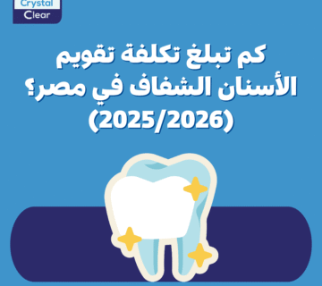 كم تبلغ تكلفة تقويم الأسنان الشفاف في مصر؟ (2025/2026)